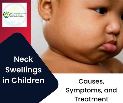 Neck Swelling In Children Causes And Treatment Dr Saurabh Tiwari