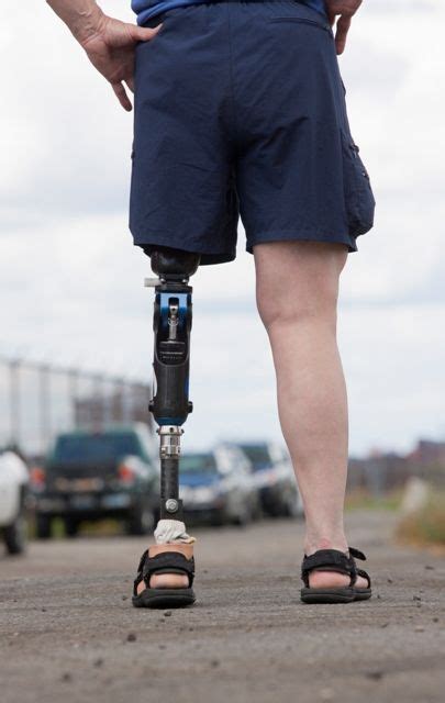 Sensory Feedback May Smooth Walking With A Prosthetic Leg Mdedge