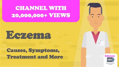 Eczema Causes Symptoms Treatment And More Youtube