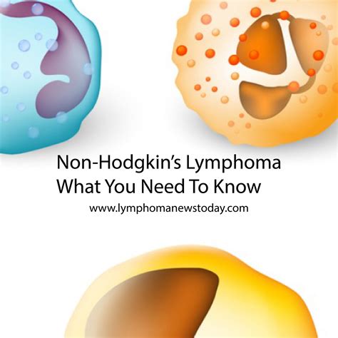 all you need to know about non hodgkin s lymphoma