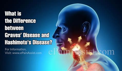 What Is The Difference Between Graves Disease And Hashimotos Disease