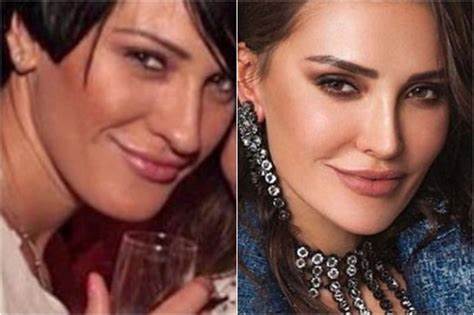 Диета ксения бурда Ксения бурда фото до и после пластики фото Ксения бурда фото до и после пластики фото Диета ксения бурда