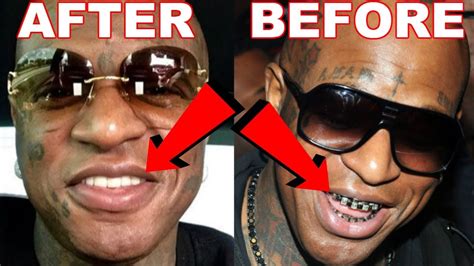 Lil wayne's response was, no, it's not a grill because c…come out…imma die with these. way: lil wayne teeth without grill