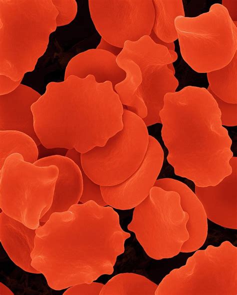 Red Blood Cells In Hypertonic Solution Photograph By Dennis Kunkel
