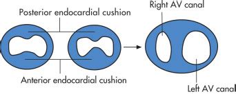 Cardiac Imaging Radiology Key