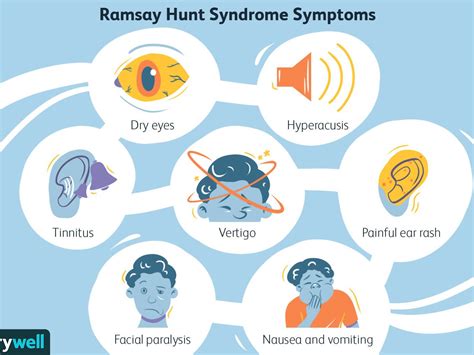 What Causes Ramsay Hunt Syndrome Type 2