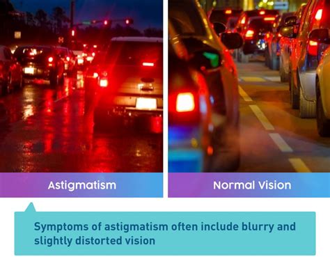What Is Astigmatism And Everything You Need To Know — Uniqso