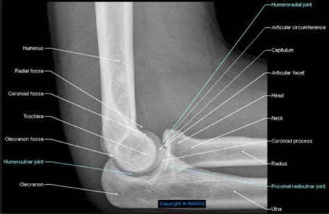 Lateromedial Projection Lateral Position Elbow Radiology Radiology