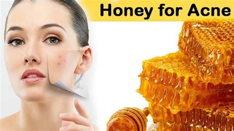 how to use honey for acne youtube
