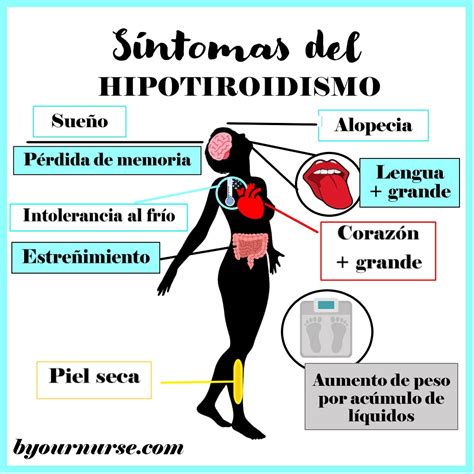 Sintomas Hipotiroidismo