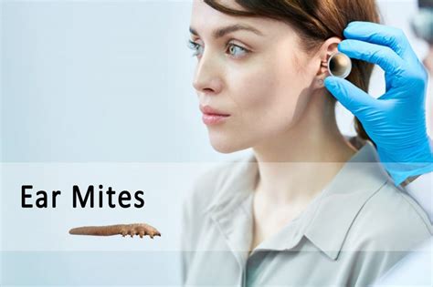 Ear Mites In Humans Symptoms And Treatment Ungex