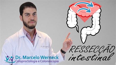 Cirurgia Para Retirar Fezes Do Intestino