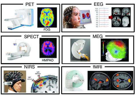 12 Overview Of The Most Common Non Invasive Functional Neuroimaging