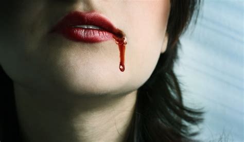 Кровь изо рта причины как остановить чем помочь когда нужна помощь врача