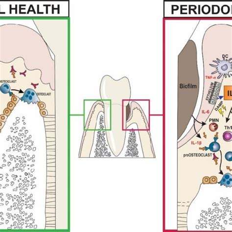 Role Of IL In The Immunopathogenesis Of Periodontitis Download Scientific Diagram