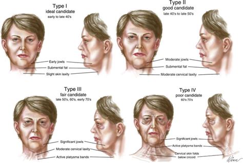 Correction Of The Lower Third Of The Face And Submental Area In Various