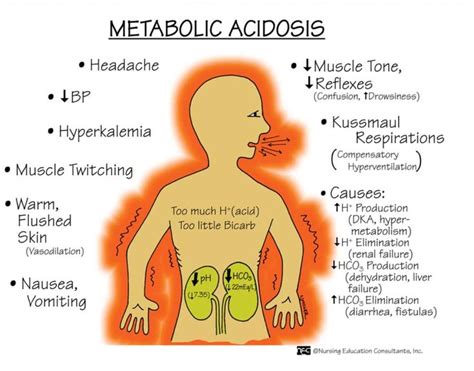 Pin By Kristen Krauss On School Nursing Mnemonics Metabolic Acidosis