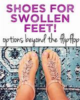 Shoes For Swollen Pregnant Feet