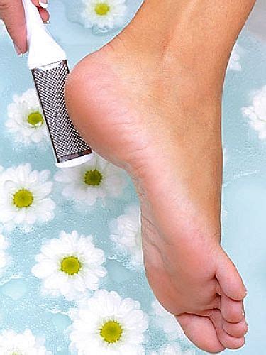 Home Remedies For Cracked Heels Causes Treatment Prevention