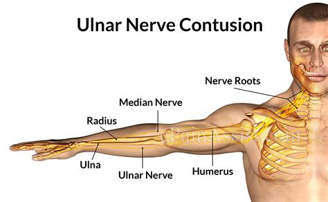 Ulnar Nerve Contusionsymptomscausestreatment Cold Therapy Cast