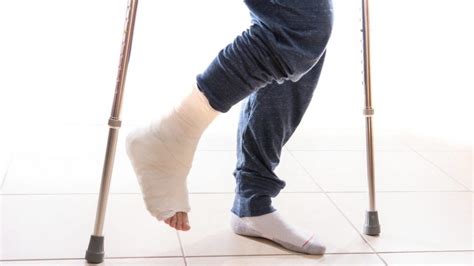 Living Alone With A Broken Ankle These 7 Tips Will Make Your Life
