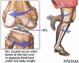 Exercise Program Post Acl Surgery Images