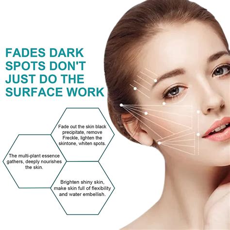 Buy Elaimei Freckle Remover Cream Dark Spot Remover Corrector Age Spot Remover Anti Aging