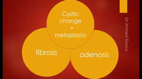 Breast Fibrocystic Change Fibroadenosis Sonomammography Mri Youtube