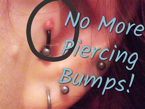 Apr 03, 2019 · to make the sea salt home remedy to get rid of an infected nose piercing bump, do the following: Secret to Getting Rid of Piercing Bumps OVERNIGHT! | DIY🖤 ...
