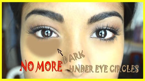 How To Conceal Dark Under Eye Circles Special Trick Dark Under Eye