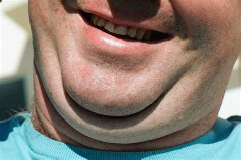 How To Get Rid Of A Double Chin Mens Health Magazine Australia