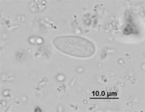 Cyst Of Giardia Peramelis Light Microscopy Download Scientific Diagram