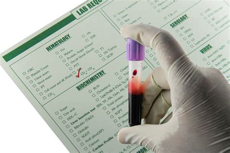Specimen Blood Sample Stock Photo Download Image Now Istock