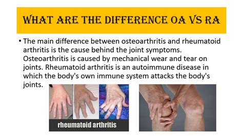 Versus Arthritis