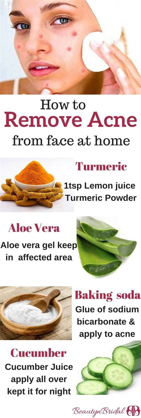 get rid of acne marks and scars with easy home remedies