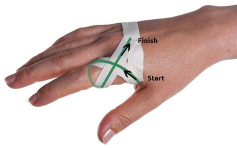 Sprained Knuckle Taping Athletic Training Sports Medicine Sports