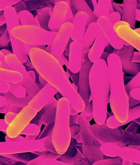 Clostridium Sporogenes Photograph By Dennis Kunkel Microscopyscience