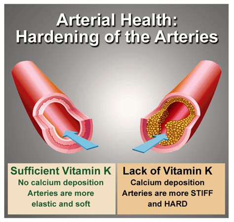 K2 is both a tissue and bacterial product (derived from vitamin k1 in both cases) and is usually found in animal products or fermented foods. Vitamine K2 - OERsterk