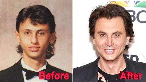 Jonathan Cheban Plastic Surgery Before And After
