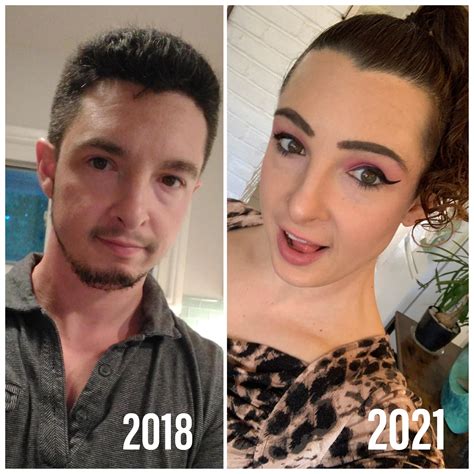 39 mtf 2 years 2 months hrt and 17 days postop last pic was a day before my gcs r transtimelines