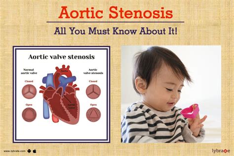 Aortic Stenosis All You Must Know About It By Dr Gaurav Agrawal Pediatric Cardiologist