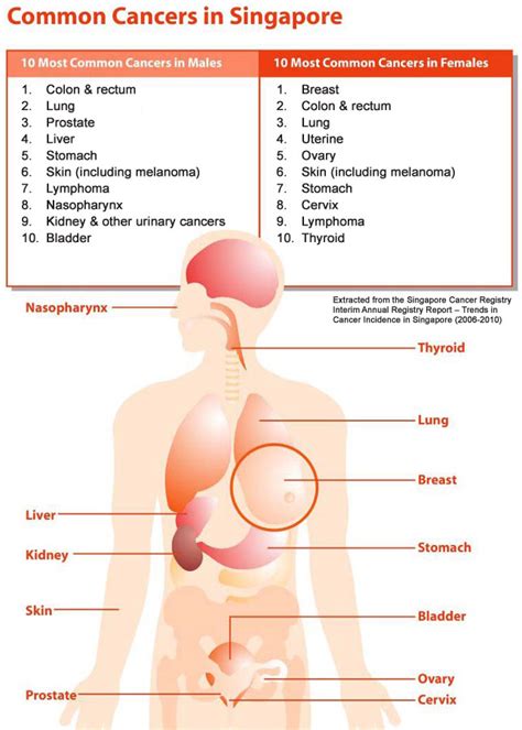 Common Cancers In Men And Women In Singapore