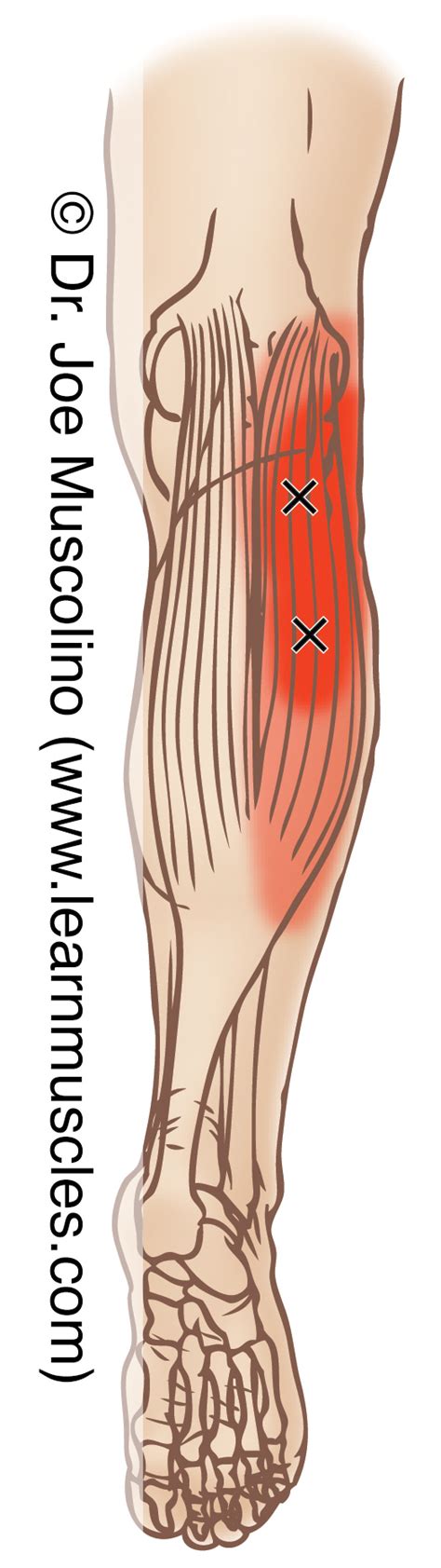 Gastrocnemius Trigger Points Learn Muscles