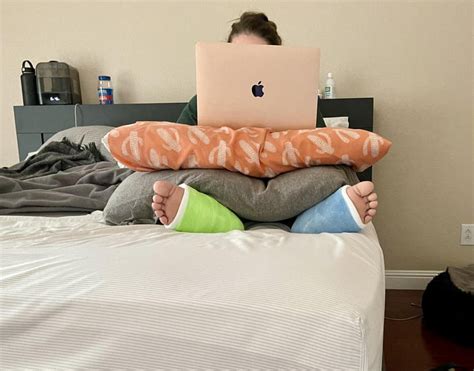 Broke Both Her Legs Working From Home Turned Into Working From Bed 9gag