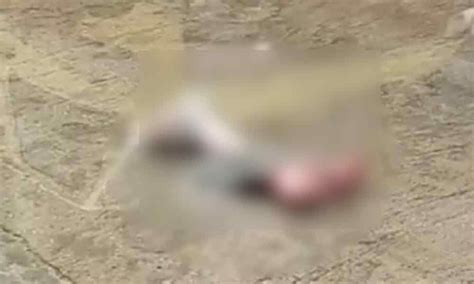 Amputated Human Leg Found In Drain In Hyderabad