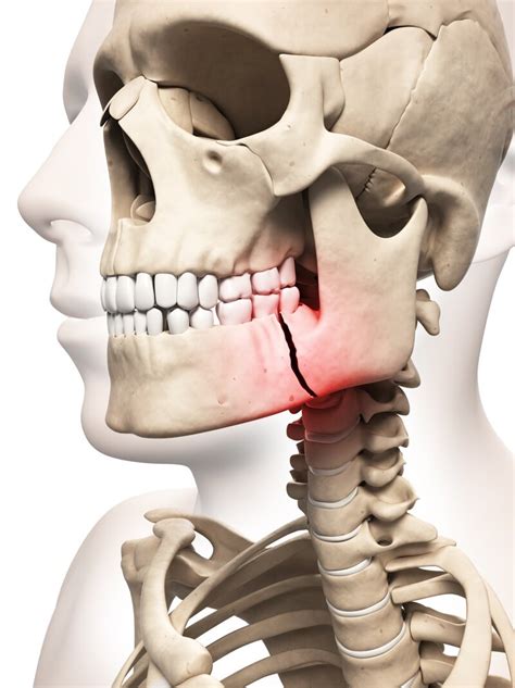 Facial Trauma SD Oral Surgery