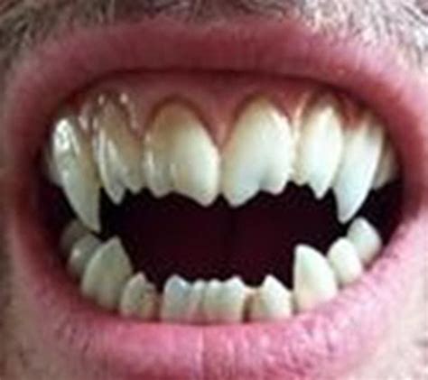 175 Best Images About Teeth On Pinterest Wolves Sharks And Mouths