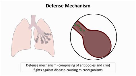 Pathophysiology Of Pneumonia Youtube