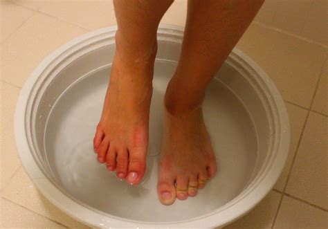 Reasons behind dead skin cells on feet. How to Use Baking Soda to Remove Foot Calluses - xRemedies.com