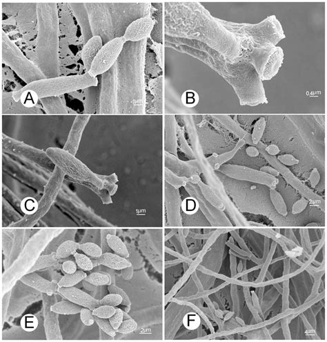 Morphological Features Of Cladosporium Cladosporioides Under A Scanning